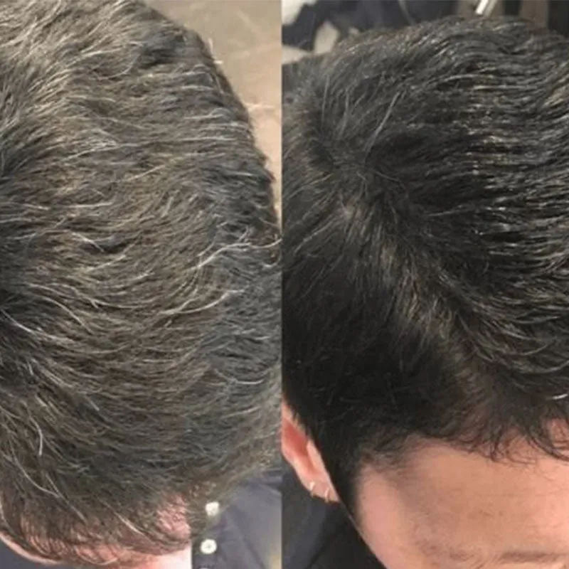 2024 Summer Sale 48% OFFHair Instant Dye Shampoo
